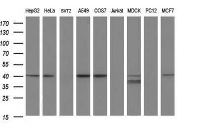Western Blot: Alpha-parvin/Actopaxin Antibody (OTI1C10)Azide and BSA Free [NBP2-72018]