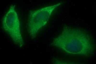 Immunofluorescence: Alpha-parvin/Actopaxin Antibody (OTI1C10) [NBP2-46326]