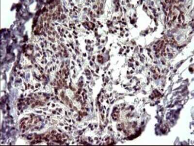 Immunohistochemistry: Alpha-parvin/Actopaxin Antibody (OTI1C10) [NBP2-46326]