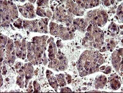 Immunohistochemistry: Alpha-parvin/Actopaxin Antibody (OTI1C10) [NBP2-46326]