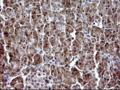 Immunohistochemistry: Alpha-parvin/Actopaxin Antibody (OTI1C10) [NBP2-46326]