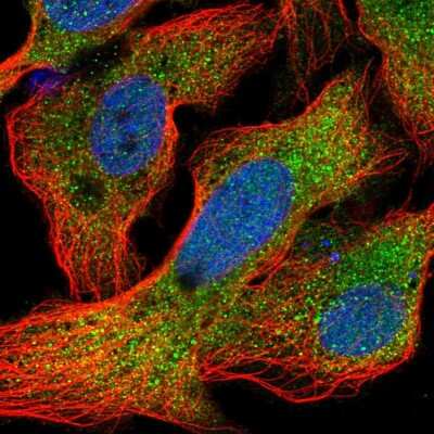 Immunocytochemistry/ Immunofluorescence: AlphaA Crystallin/CRYAA Antibody [NBP2-55161]