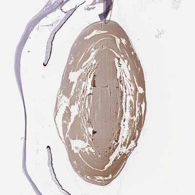 Immunohistochemistry: AlphaA Crystallin/CRYAA Antibody [NBP2-68634]