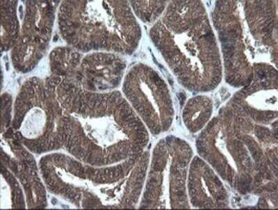Immunohistochemistry: AlphaA Crystallin/CRYAA Antibody (OTI3B12) - Azide and BSA Free [NBP2-70450]