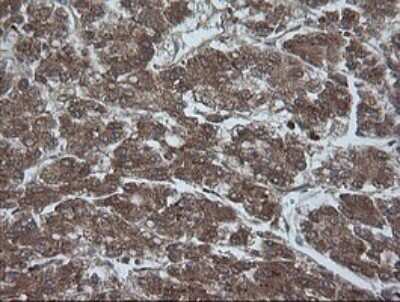 Immunohistochemistry: AlphaA Crystallin/CRYAA Antibody (OTI3B12) - Azide and BSA Free [NBP2-70450]