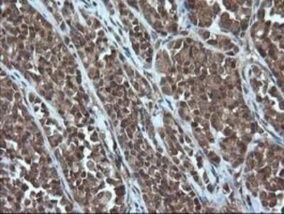Immunohistochemistry: AlphaA Crystallin/CRYAA Antibody (OTI3B12) - Azide and BSA Free [NBP2-70450]
