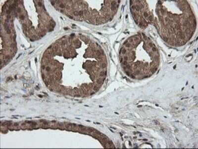 Immunohistochemistry: AlphaA Crystallin/CRYAA Antibody (OTI3B12) - Azide and BSA Free [NBP2-70450]