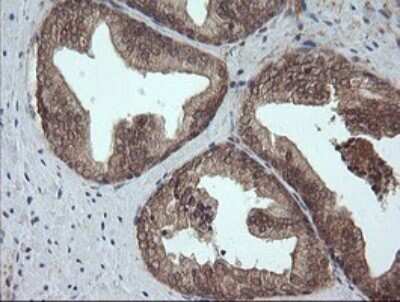 Immunohistochemistry: AlphaA Crystallin/CRYAA Antibody (OTI3B12) [NBP2-46354]