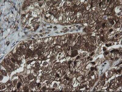 Immunohistochemistry: AlphaA Crystallin/CRYAA Antibody (OTI3B12) [NBP2-46354]