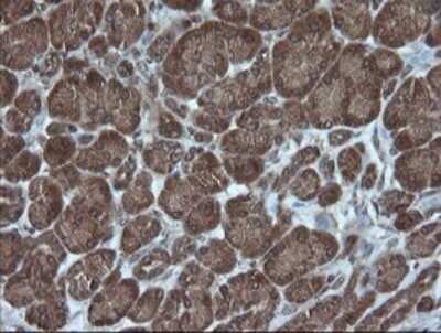 Immunohistochemistry: AlphaA Crystallin/CRYAA Antibody (OTI3B12) [NBP2-46354]