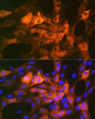 Immunocytochemistry/ Immunofluorescence: AlphaB Crystallin/CRYAB Antibody (6C9R1) [NBP3-16844]