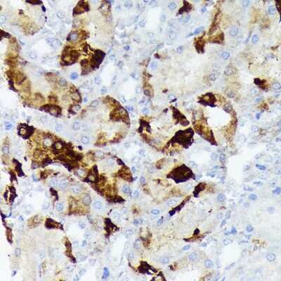 Immunohistochemistry-Paraffin: AlphaB Crystallin/CRYAB Antibody (6C9R1) [NBP3-16844]