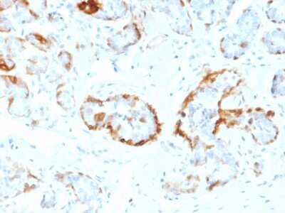 Immunohistochemistry-Paraffin: AlphaB Crystallin/CRYAB Antibody (CPTC-CRYAB-1) [NBP3-07764]