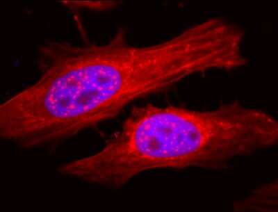 Immunocytochemistry/ Immunofluorescence: AlphaB Crystallin/CRYAB Antibody [NB120-13497]