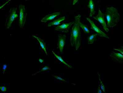 Immunocytochemistry/ Immunofluorescence: AlphaB Crystallin/CRYAB Antibody [NB120-13497]