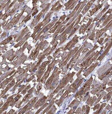Immunohistochemistry-Paraffin: AlphaB Crystallin/CRYAB Antibody [NBP2-49246]