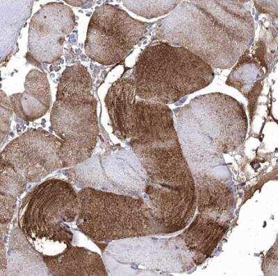 Immunohistochemistry-Paraffin: AlphaB Crystallin/CRYAB Antibody [NBP2-49246]