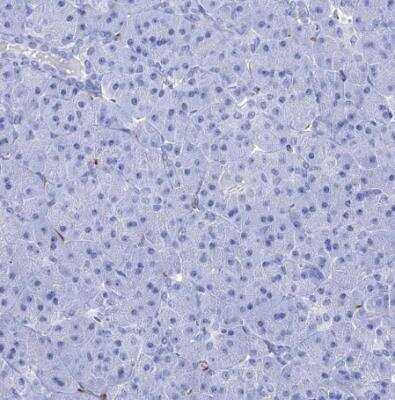 Immunohistochemistry-Paraffin: AlphaB Crystallin/CRYAB Antibody [NBP2-49246]