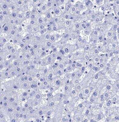 Immunohistochemistry-Paraffin: AlphaB Crystallin/CRYAB Antibody [NBP2-49246]