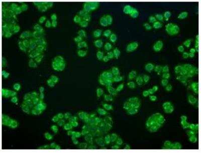 Immunocytochemistry/ Immunofluorescence: AlphaB Crystallin/CRYAB Antibody (OTI6A9) - Azide and BSA Free [NBP2-70454]
