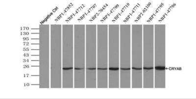 Immunoprecipitation: AlphaB Crystallin/CRYAB Antibody (OTI6A9) - Azide and BSA Free [NBP2-70454]
