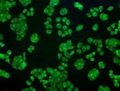 Immunocytochemistry/ Immunofluorescence: AlphaB Crystallin/CRYAB Antibody (OTI6A9) [NBP1-47708]