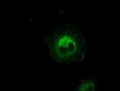 Immunocytochemistry/ Immunofluorescence: AlphaB Crystallin/CRYAB Antibody (OTI6A9) [NBP1-47708]