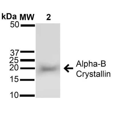 Western Blot: AlphaB Crystallin/CRYAB Antibody [NB120-13497]