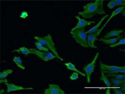Immunocytochemistry/ Immunofluorescence: Als2 Antibody (4F10) [H00057679-M02]