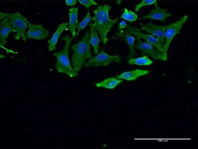 Immunocytochemistry/ Immunofluorescence: Als2 Antibody (4F10) [H00057679-M02]