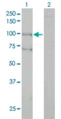 Western Blot: Als2 Antibody (4F9) [H00057679-M01]