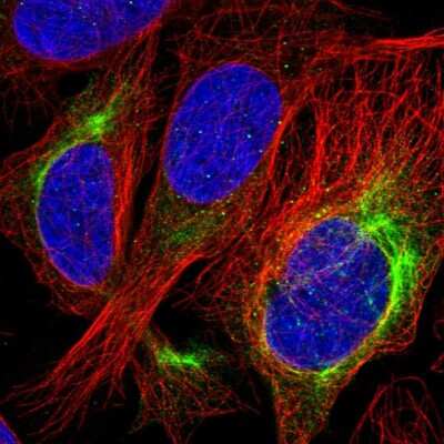 Immunocytochemistry/ Immunofluorescence: Als2 Antibody [NBP2-14284]