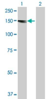 Western Blot: Als2 Antibody [H00057679-D01P]