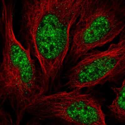 Immunocytochemistry/ Immunofluorescence: Aly Antibody [NBP2-56154]