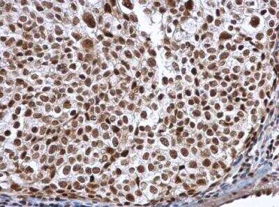 Immunohistochemistry-Paraffin: Aly Antibody [NBP1-33598]
