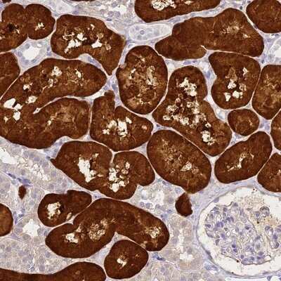 Immunohistochemistry-Paraffin: Aminoacylase/ACY1 Antibody [NBP2-14261]