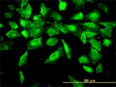 Immunocytochemistry/ Immunofluorescence: Aminoacylase/ACY1 Antibody (4F1-B7) [H00000095-M01]
