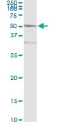 Immunoprecipitation: Aminoacylase/ACY1 Antibody (4F1-B7) [H00000095-M01]
