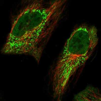 Immunocytochemistry/ Immunofluorescence: Aminomethyltransferase Antibody [NBP1-89783]