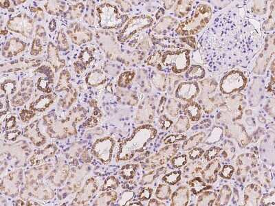 Immunohistochemistry-Paraffin: Aminomethyltransferase Antibody [NBP2-97412]