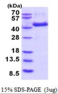 SDS-PAGE: Recombinant Human Aminomethyltransferase His Protein [NBP2-52054]