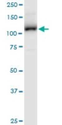 Western Blot: Aminopeptidase LRAP/ERAP2 Antibody [H00064167-B01P]