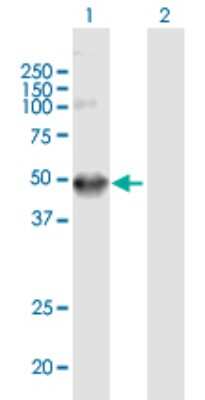 Western Blot: Aminopeptidase LRAP/ERAP2 Antibody [H00064167-B01P]