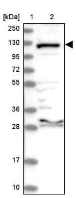 Western Blot: Aminopeptidase LRAP/ERAP2 Antibody [NBP2-37872]