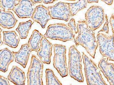 Immunohistochemistry-Paraffin: Aminopeptidase N/CD13 Antibody (101) [NBP2-90345]