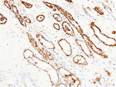 Immunohistochemistry-Paraffin: Aminopeptidase N/CD13 Antibody (122) [NBP2-89242]