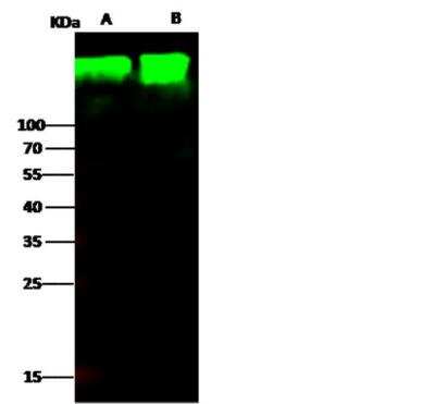 Western Blot: Aminopeptidase N/CD13 Antibody (122) [NBP2-89242]