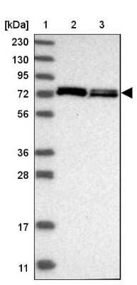 Western Blot: Aminopeptidase P1/XPNPEP1 Antibody [NBP1-80613]