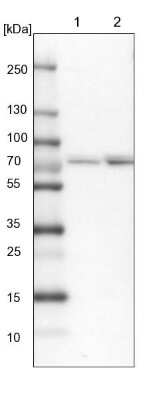 Western Blot: Aminopeptidase P1/XPNPEP1 Antibody [NBP1-80613]