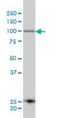 Western Blot: Aminopeptidase PILS/ARTS1 Antibody (4H8) [H00051752-M01]